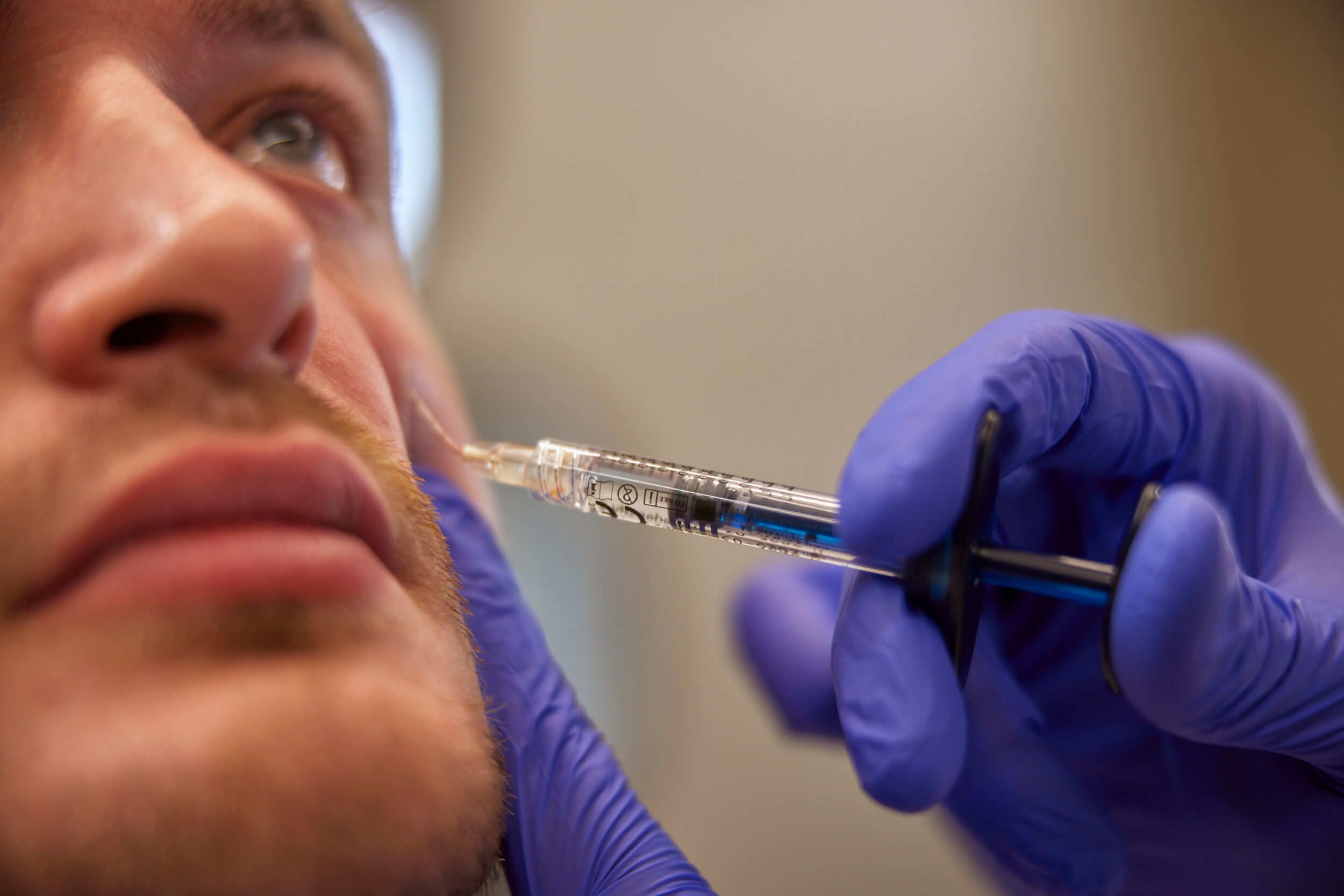 Cosmetisch arts voert fillerbehandeling uit bij client in Amsterdam Buitenveldert bij The Body Clinic