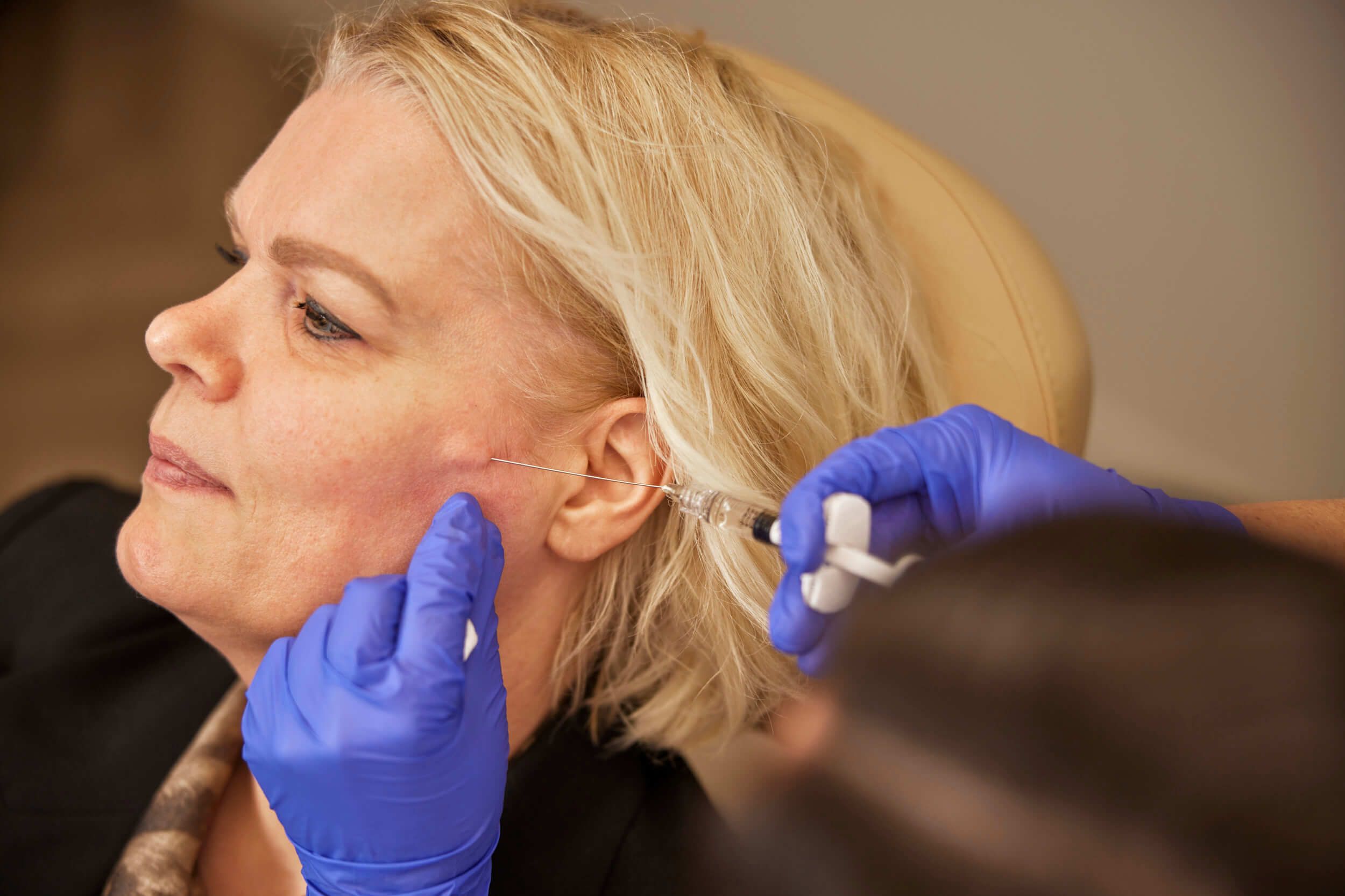 Arts injecteert in jukbeenderen tijdens behandeling met hyaluronzuurfillers bij The Body Clinic