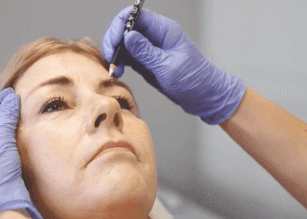 Cosmetisch arts voert liquid facelift behandeling uit bij The Body Clinic