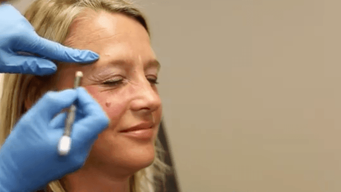 Cosmetisch arts Mirthe van der Putten voert traangoot filler behandeling uit bij The Body Clinic