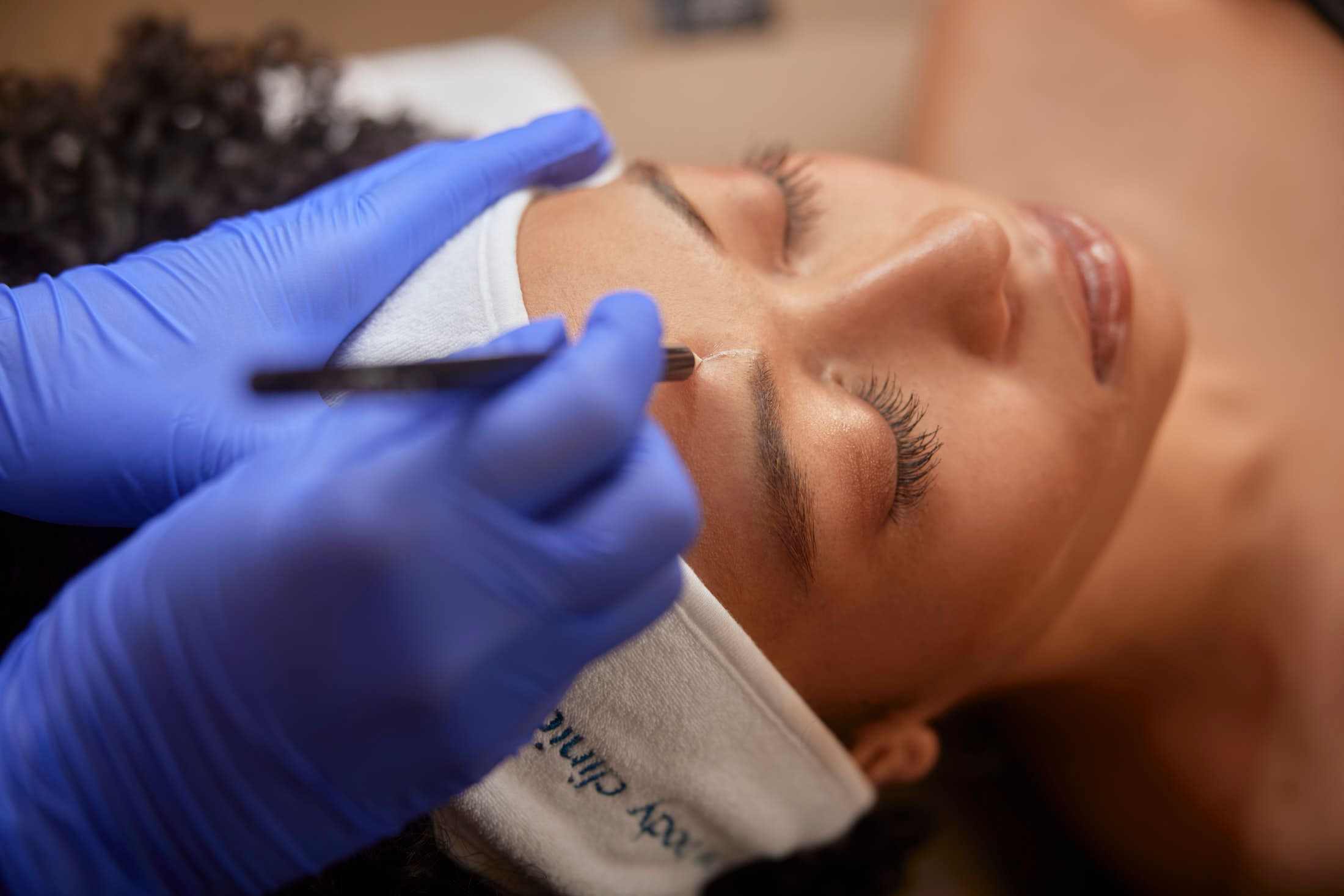 Cosmetische behandeling bij The Body Clinic Den Haag