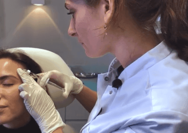 Cosmetisch arts Mirthe van der Putten voert haarfiller behandeling tegen haarverlies uit in instructievideo bij The Body Clinic