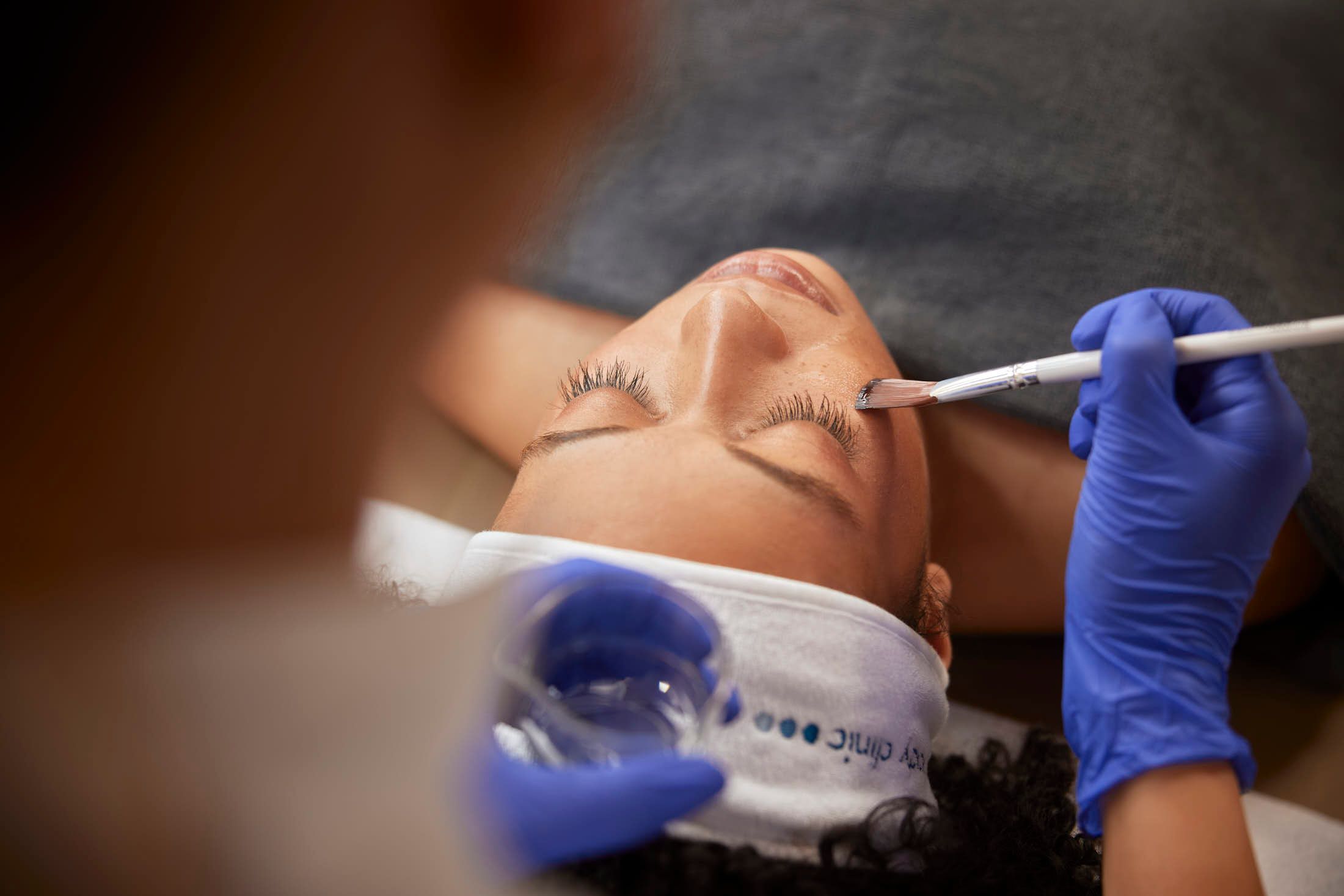 Huidtherapeut brengt chemische peeling aan op gezicht bij The Body Clinic