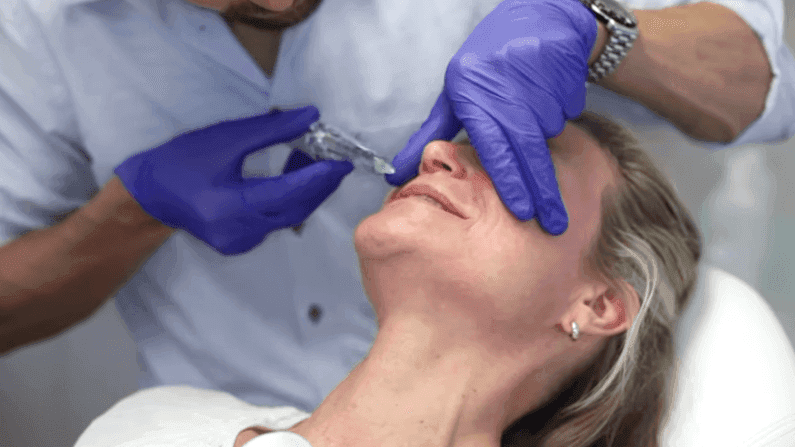 Cosmetisch arts Bart Biermans legt de Teosyal Pen voor precisie fillerbehandeling uit bij The Body Clinic