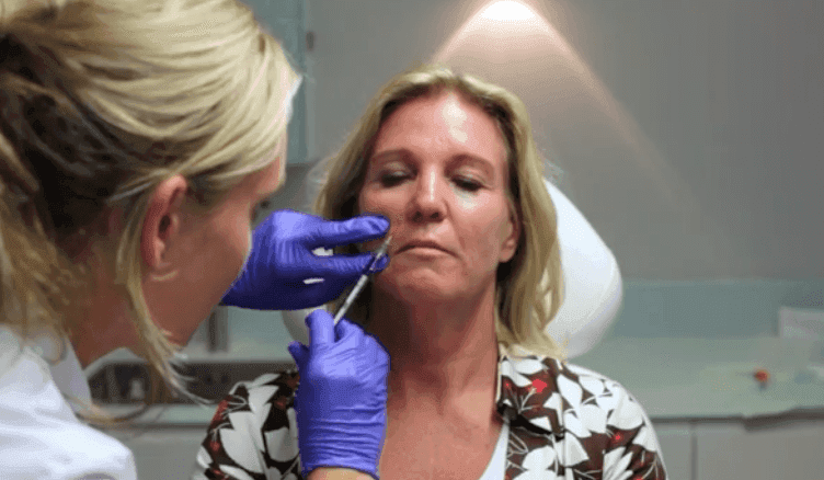 Cosmetisch arts voert neus-lippenplooi fillerbehandeling uit bij The Body Clinic