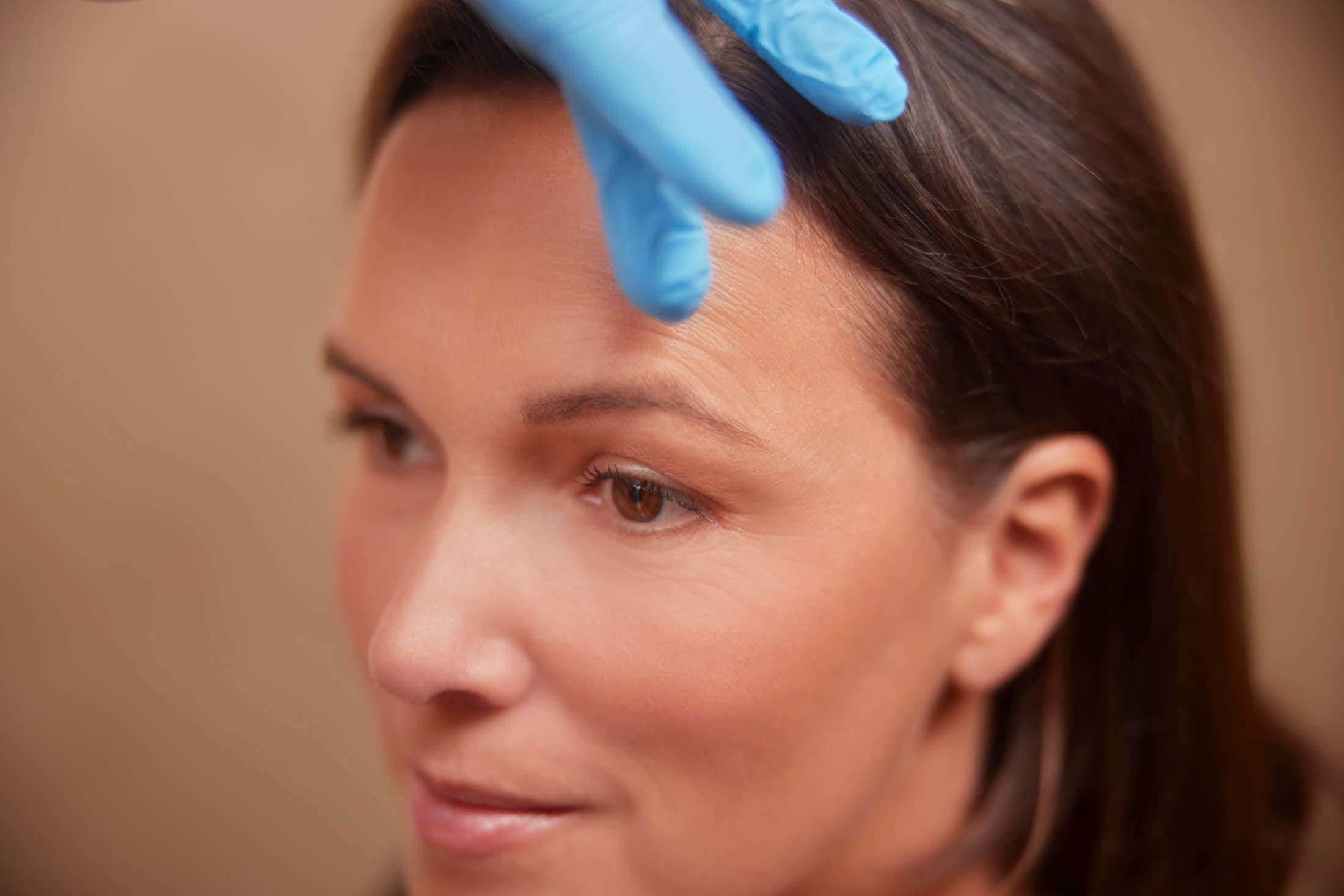 Client tijdens voorbereiding bovenooglidcorrectie bij The Body Clinic