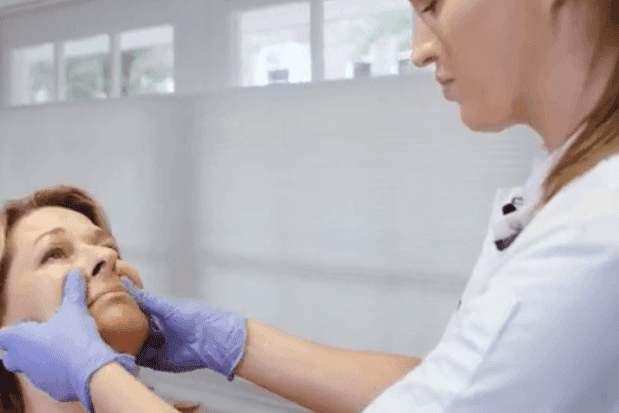 Cosmetisch arts legt fillerbehandeling voor neus-lippenplooi uit in instructievideo bij The Body Clinic