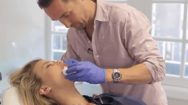 Cosmetisch arts Bart Biermans legt bovenlip filler behandeling uit bij The Body Clinic