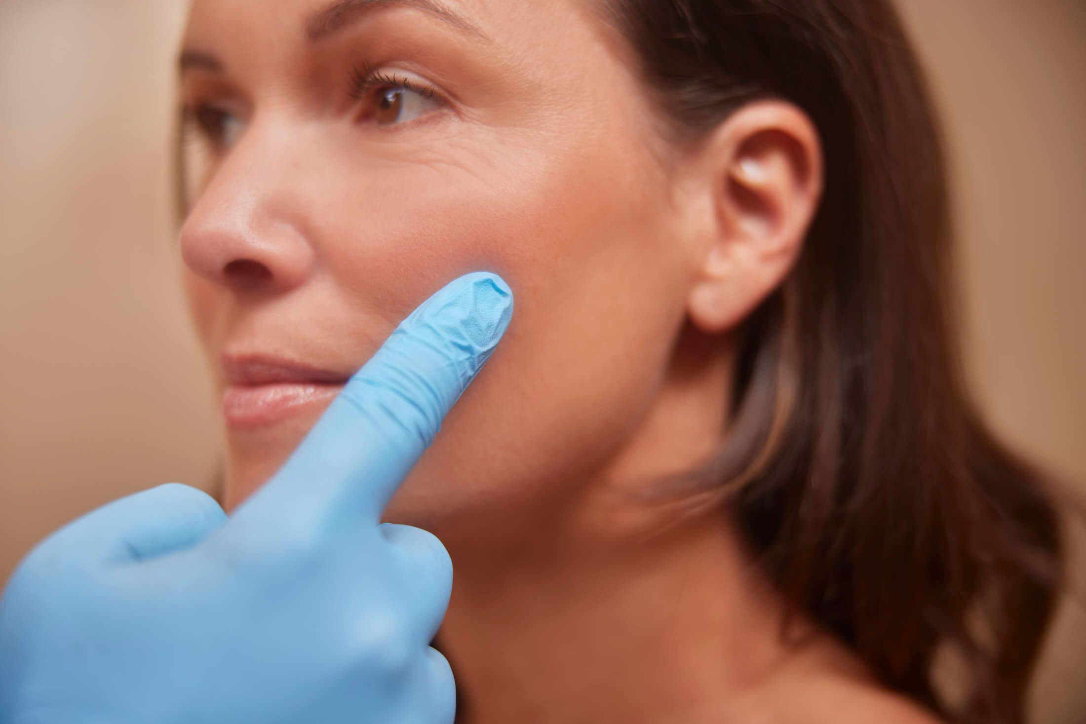 Vrouwelijke client bij controleafspraak na jukbeenderen filler behandeling bij The Body Clinic