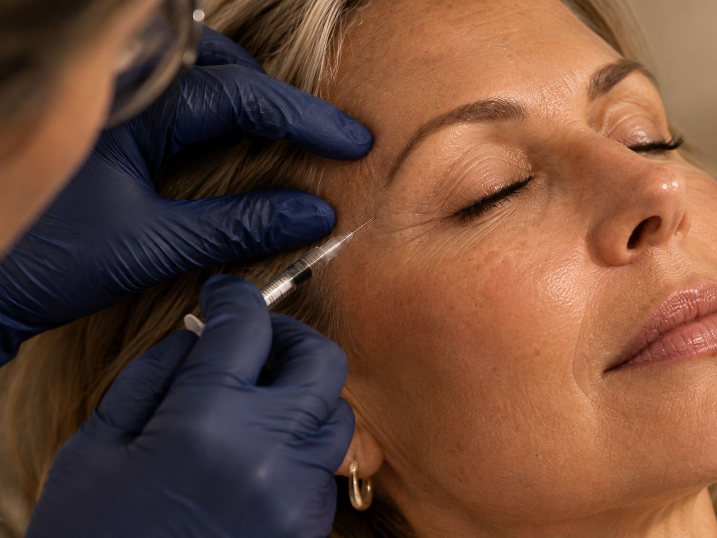 Woman receiving a cosmetic injection near her temple from a gloved professional.