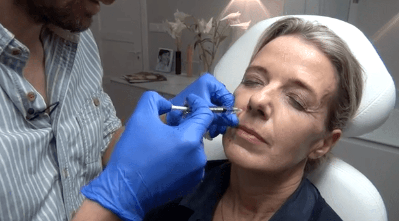 Cosmetisch arts Bart Biermans legt liquid facelift behandeling uit bij The Body Clinic