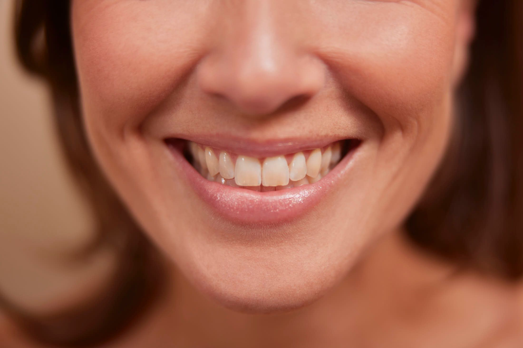 Client met frisse glimlach na bunny lines botox behandeling bij The Body Clini