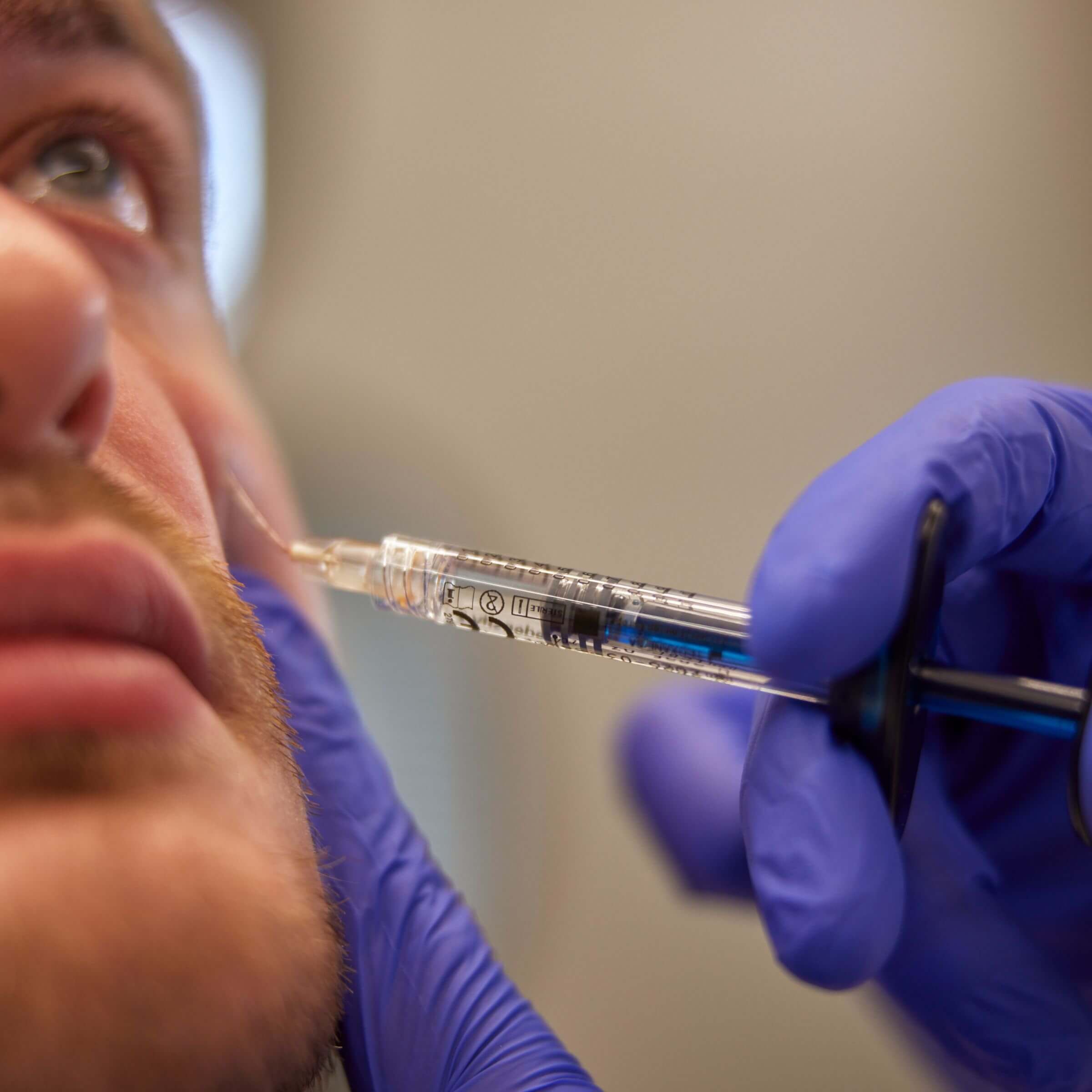 Hyaluronzuur behandeling: snelle en pijnloze injecties met kosteloze touch-up bij The Body Clinic