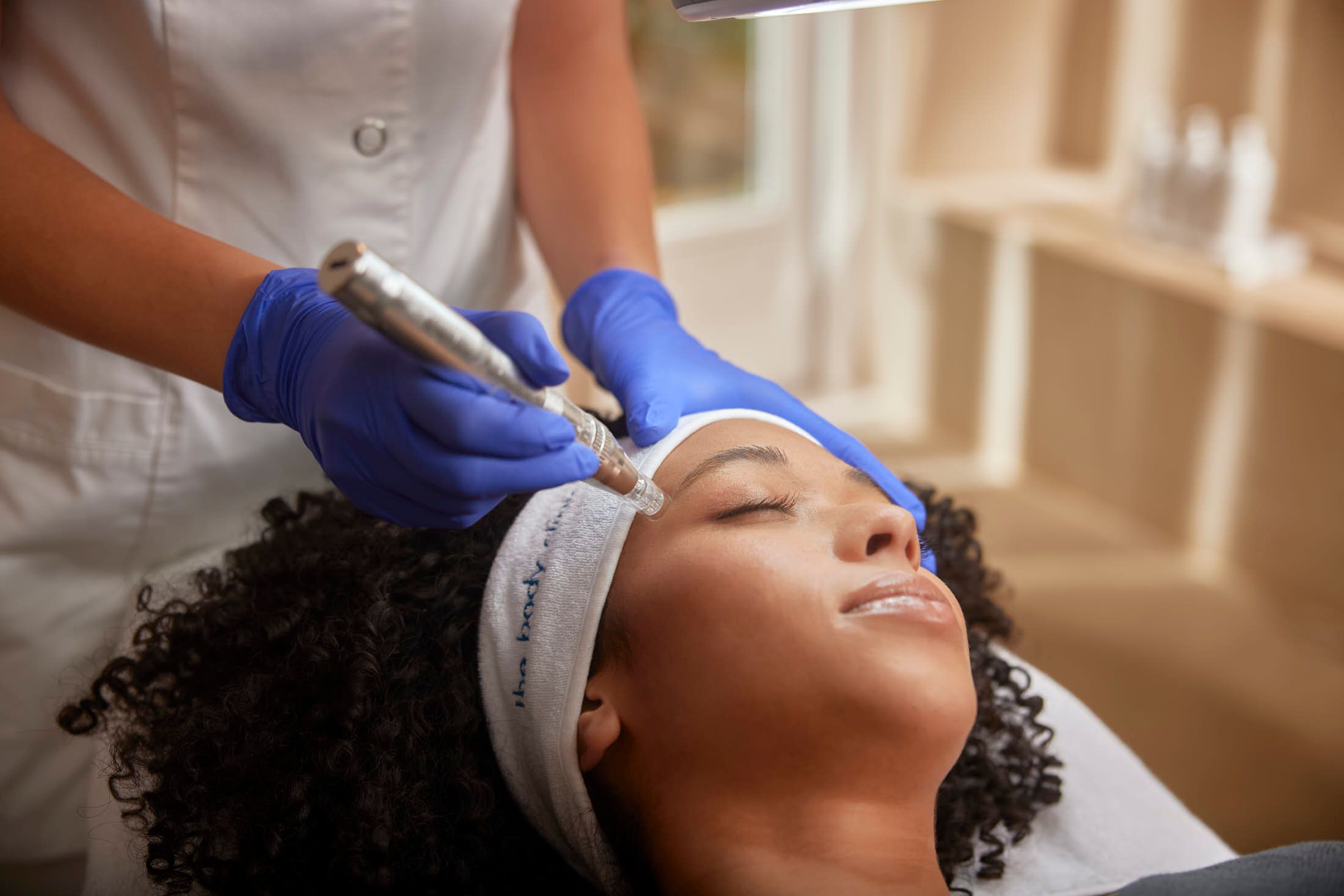 Huidtherapie behandeling met peeling, microneedling en PDRN bij The Body Clinic