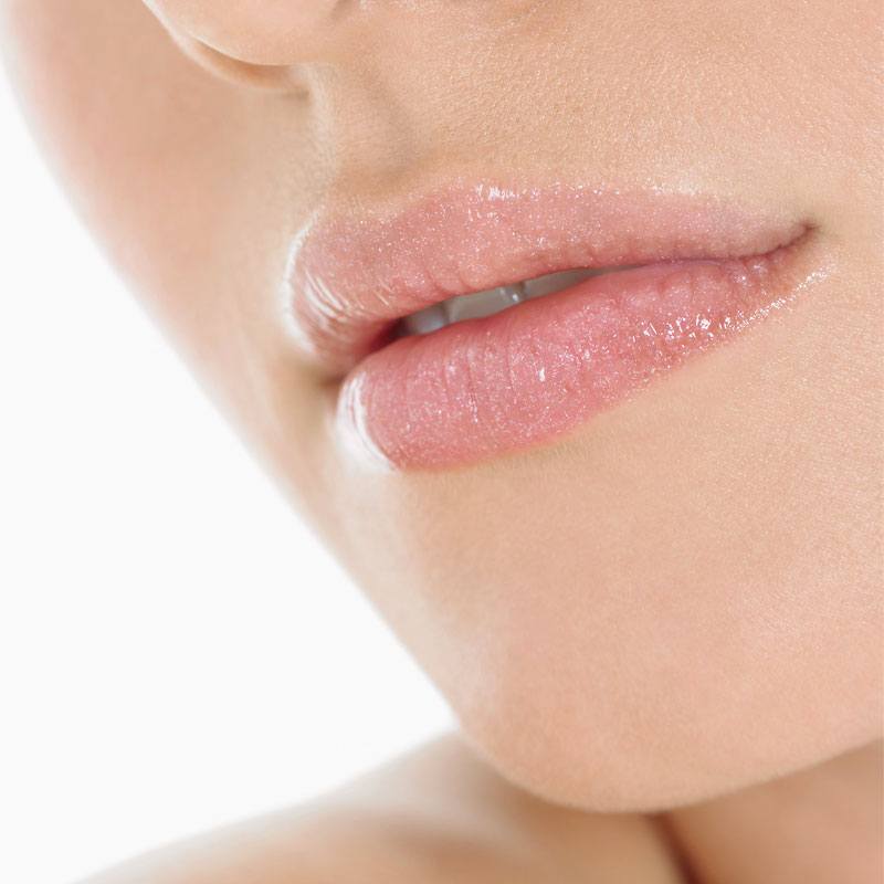 Lippen opvullen met lipfillers - De Botoxspecialist