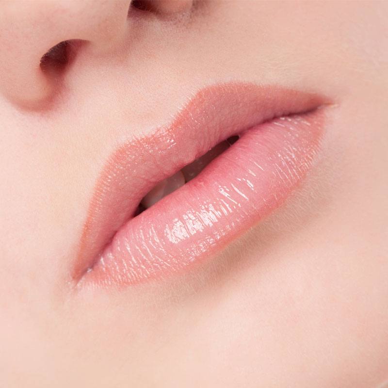 Lippen opvullen gallery 6