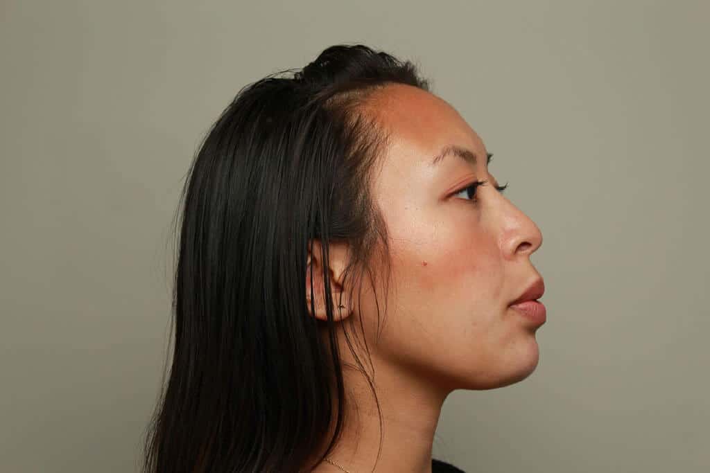 na foto rechts kin vrouw na foto rechts kin vrouw