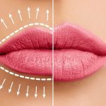 22bodyclinic lipfillers hoelang22jpg