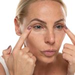 de beste alternatieven voor traangoot filler blog the body clinic