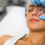 lip filler migratie voorkomen hoe zit dat blog the body clinic