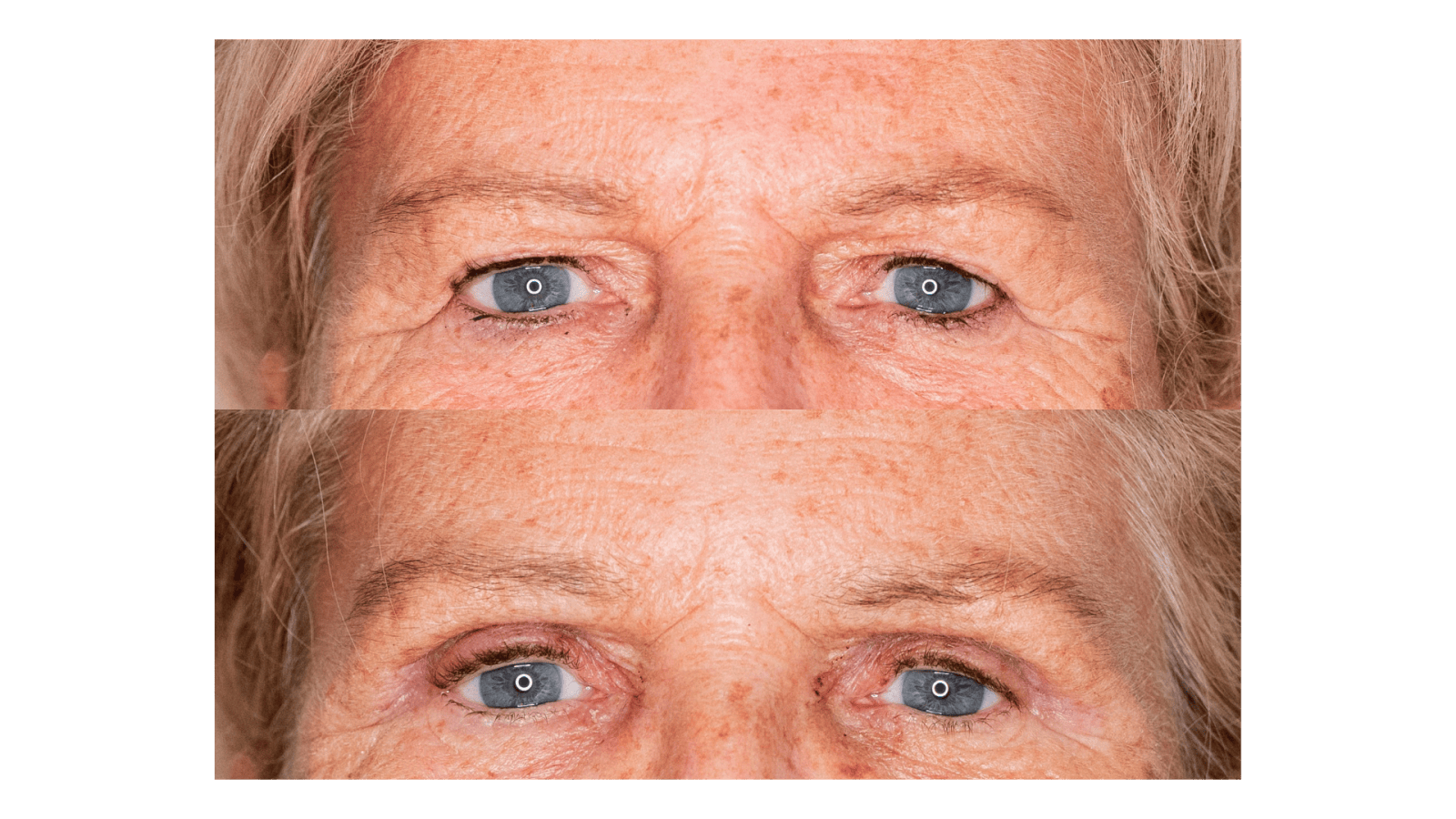 boc voor en na the body clinic 1