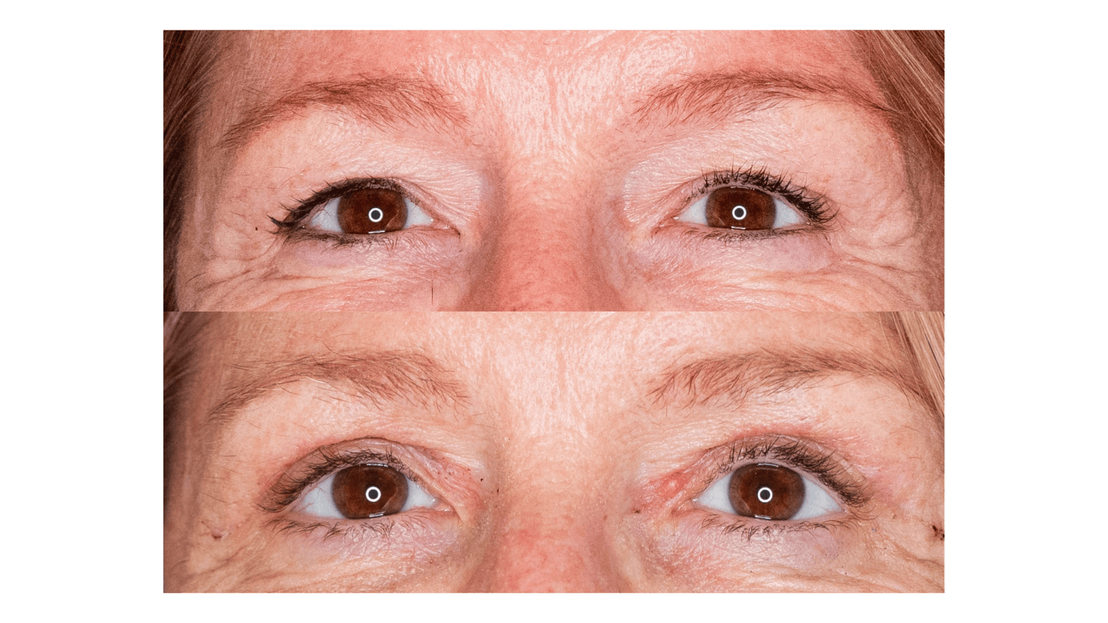 boc voor en na the body clinic 2